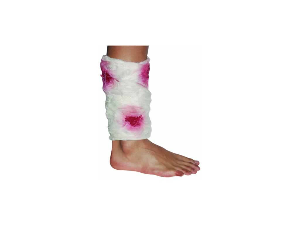 Bandage ensanglanté pour pied 